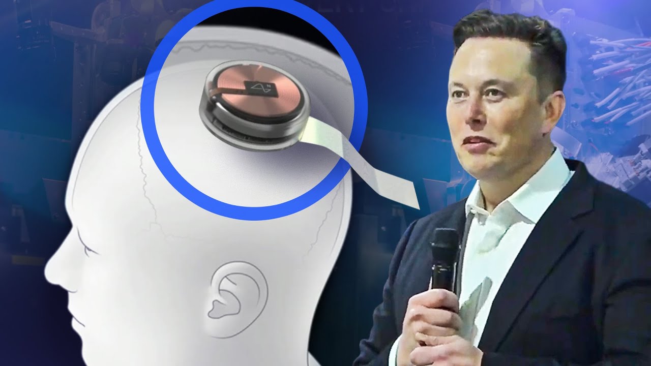 Tech Evolution] – Neuralink Milik Elon Musk dan Neuro Linker dari Accel  World, Apakah Sama? - AniEvo ID