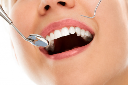 5 tips alami memutihkan gigi dengan bahan sederhana yang tersedia di sekitar kita